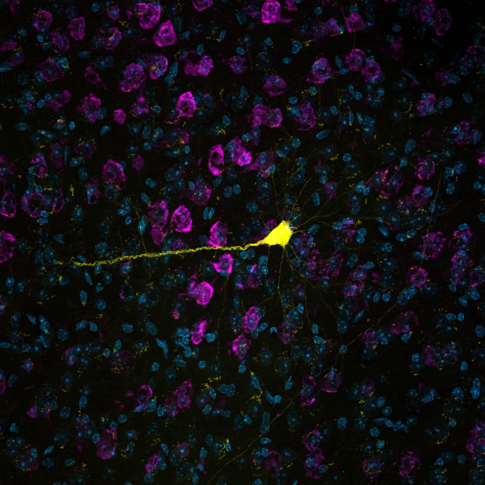 Placeholder micrograph — Brain