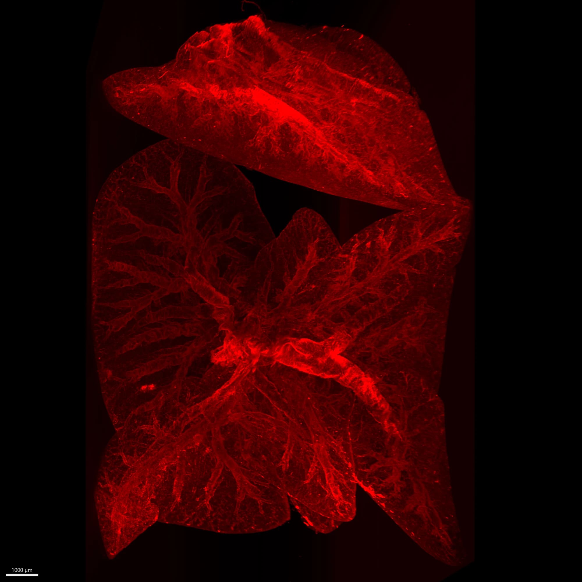 Placeholder micrograph — Lung