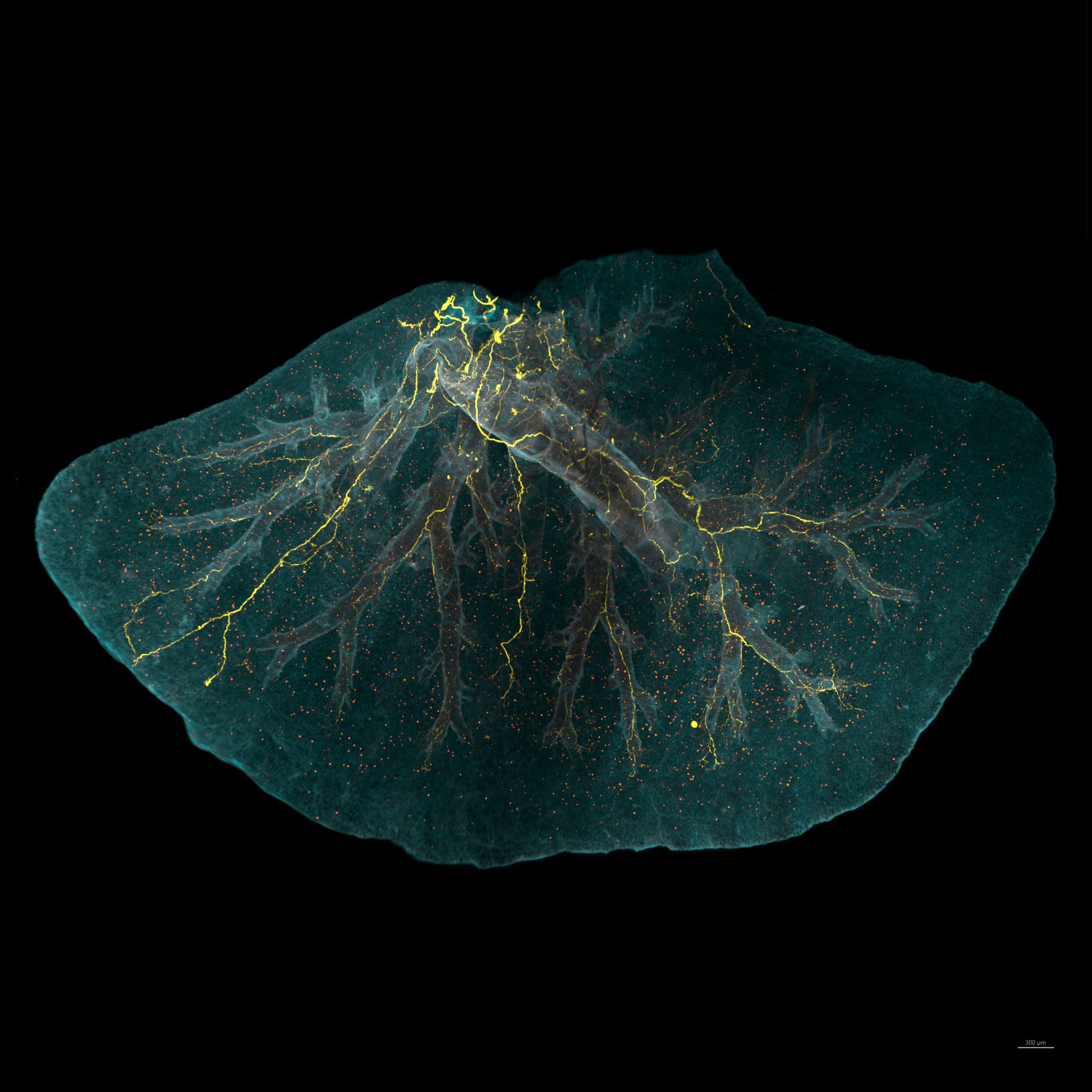 Lung
