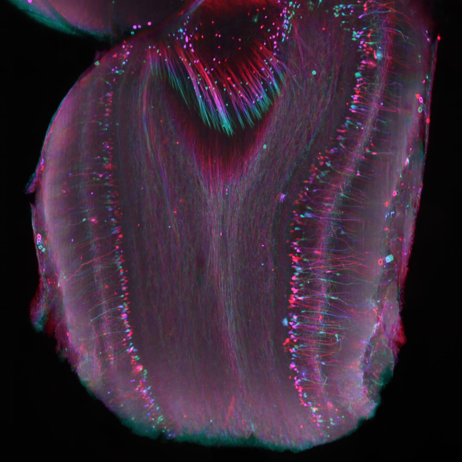Brain