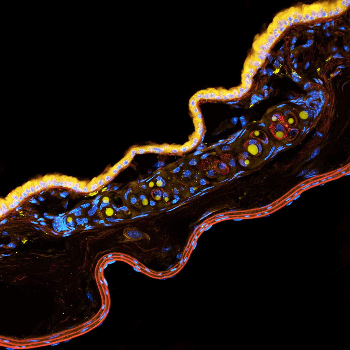Lung
