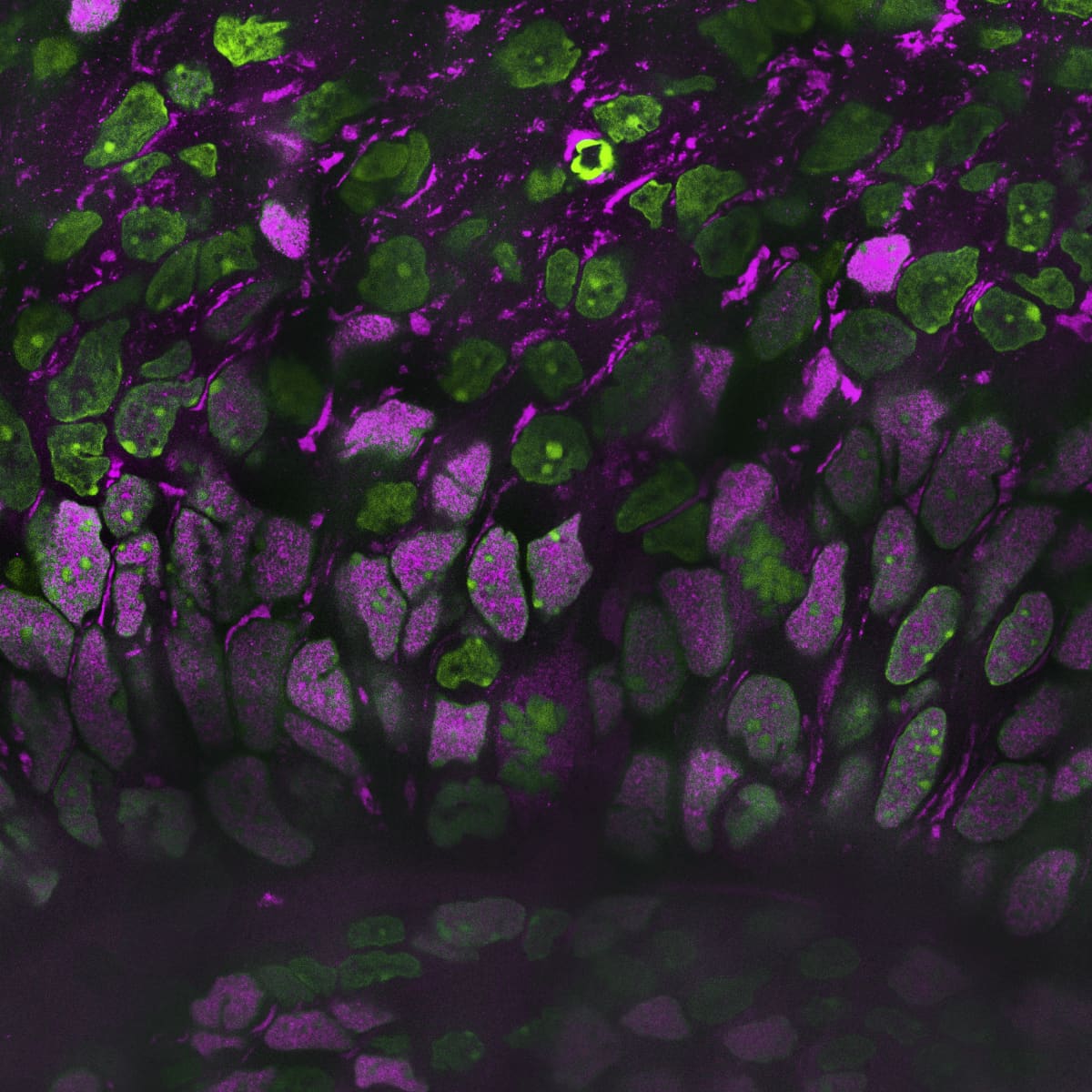Organoid