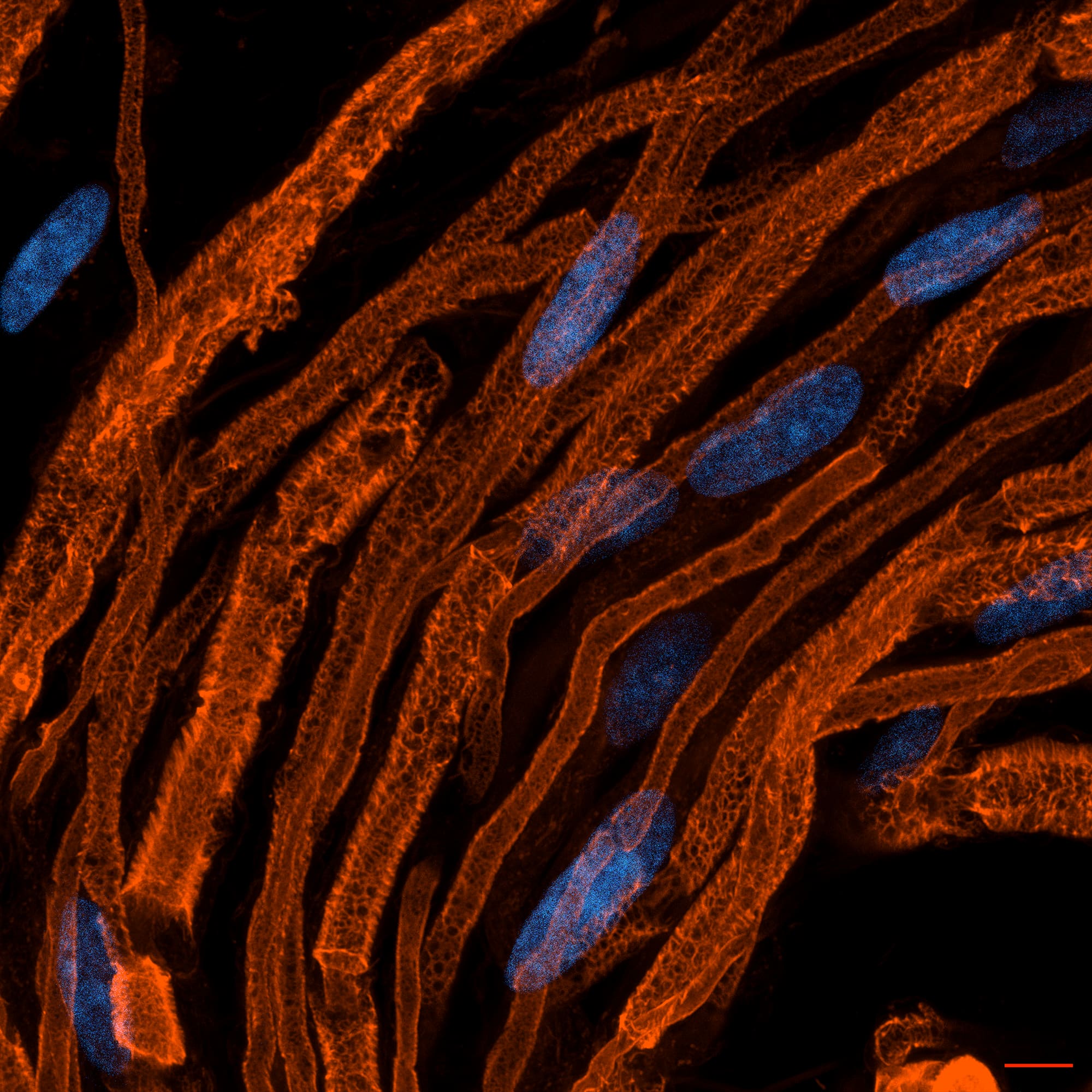 Peripheral nervous system